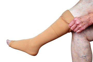 How Compression Garments Can Help Your Spider Veins