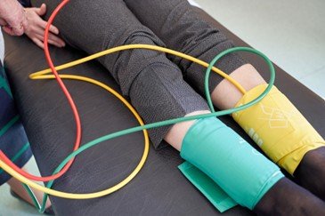 What Is an ABI (Ankle-Brachial Index)?