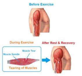 From Workout to Recovery: Understanding How to Efficiently Manage your Muscle Pump